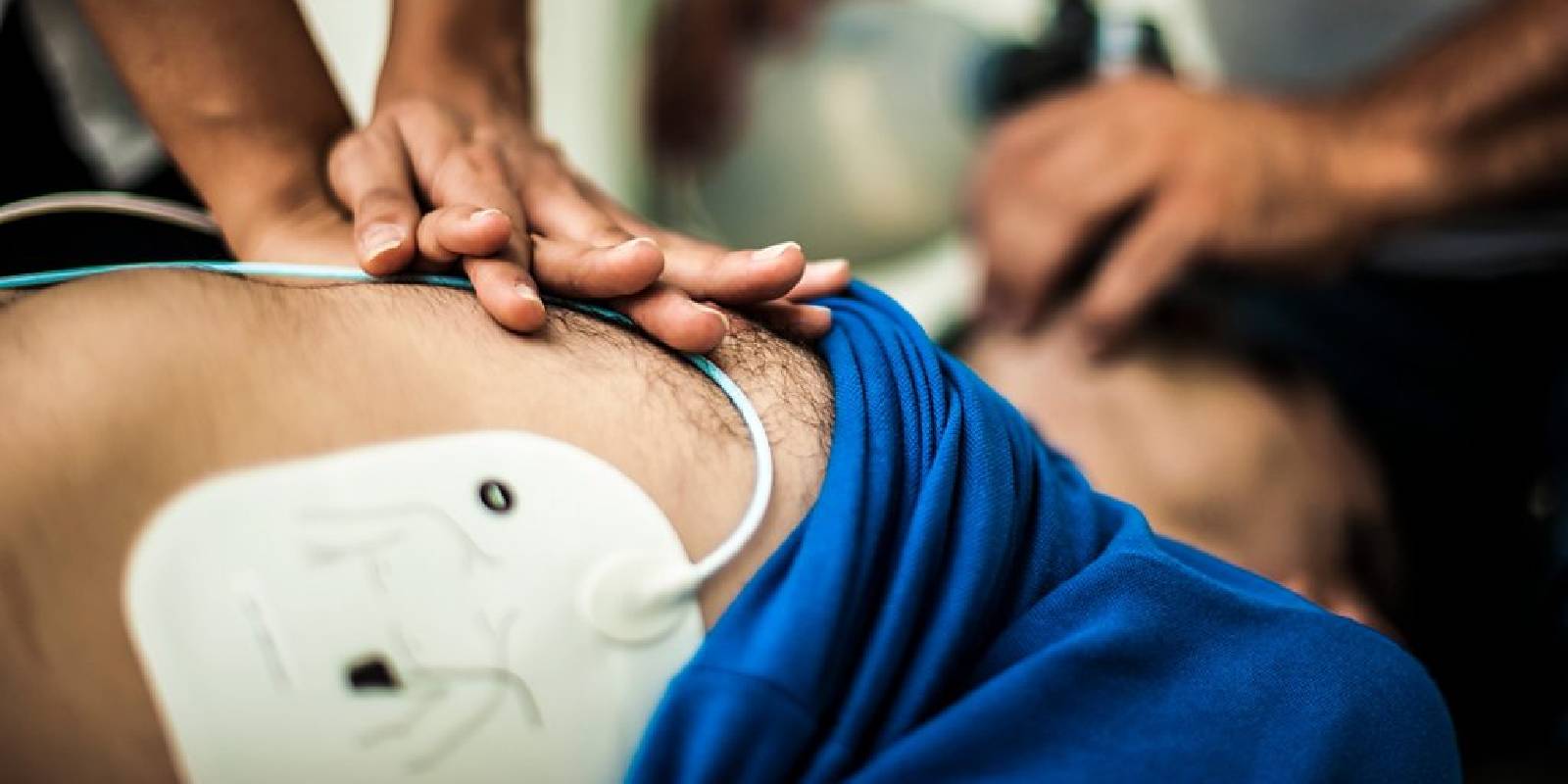 Why Do Electrode Pads Expire?